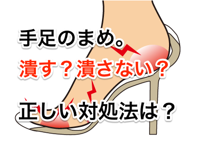手足のまめ 潰す?潰さない?正しい対処法は?