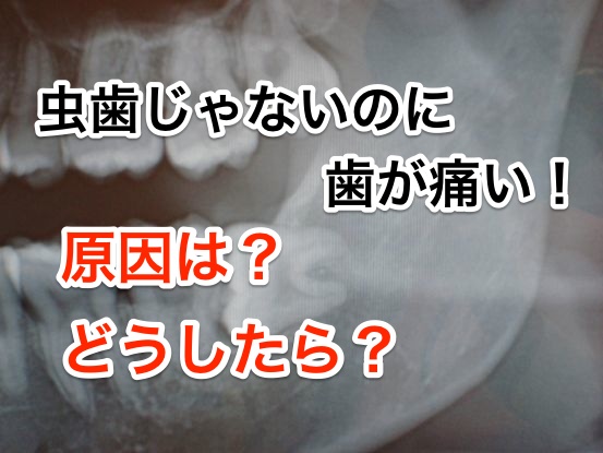 虫歯じゃないのに奥歯が痛い?それ◯◯が原因かも。
