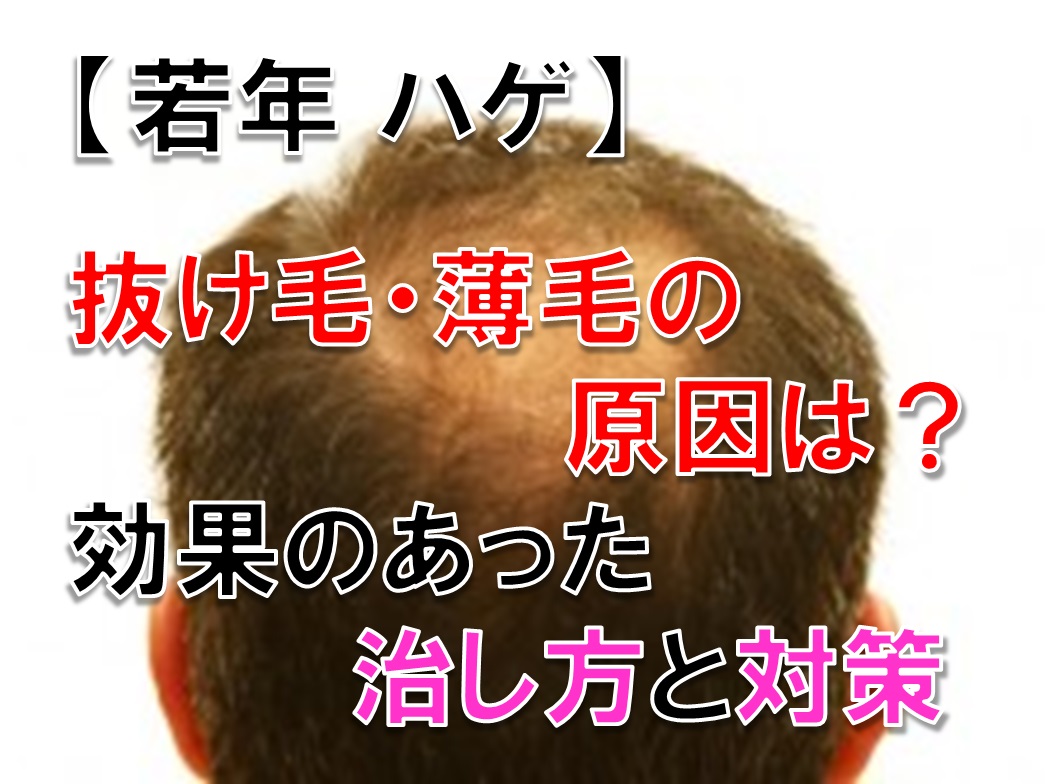 若年のハゲ・抜け毛・薄毛の原因。自分に効果のあった治し方と対策を紹介する。